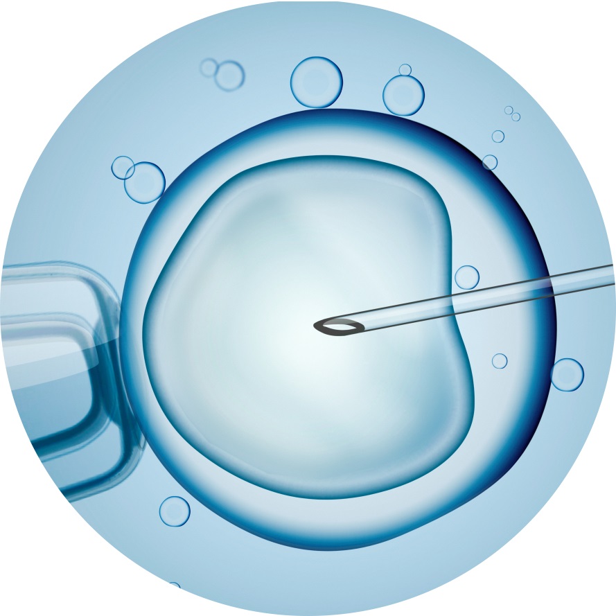 Fertility & IVF